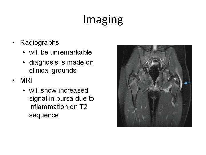 Imaging • Radiographs • will be unremarkable • diagnosis is made on clinical grounds
