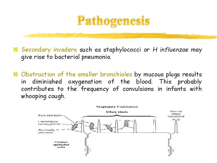 Pathogenesis z Secondary invaders such as staphylococci or H influenzae may give rise to