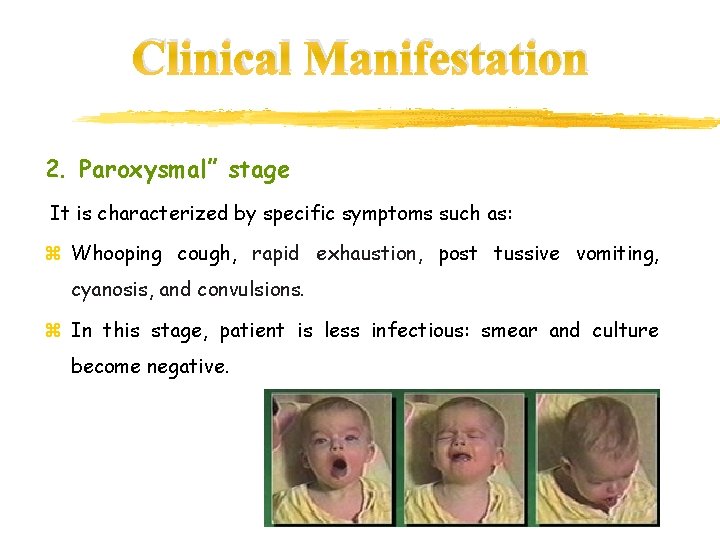 Clinical Manifestation 2. Paroxysmal” stage It is characterized by specific symptoms such as: z