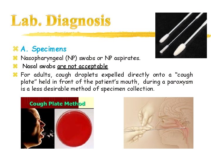 Lab. Diagnosis z A. Specimens z Nasopharyngeal (NP) swabs or NP aspirates. z Nasal