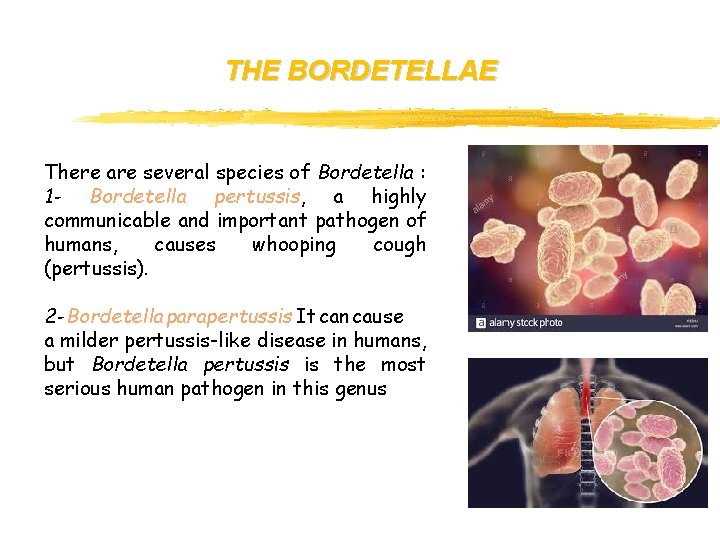 THE BORDETELLAE There are several species of Bordetella : 1 - Bordetella pertussis, a