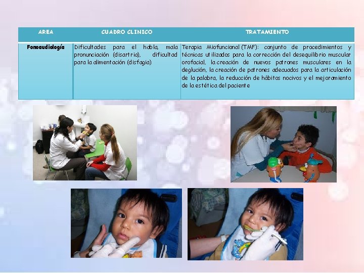 AREA Fonoaudiología CUADRO CLINICO TRATAMIENTO Dificultades para el habla, mala Terapia Miofuncional (TMF): conjunto