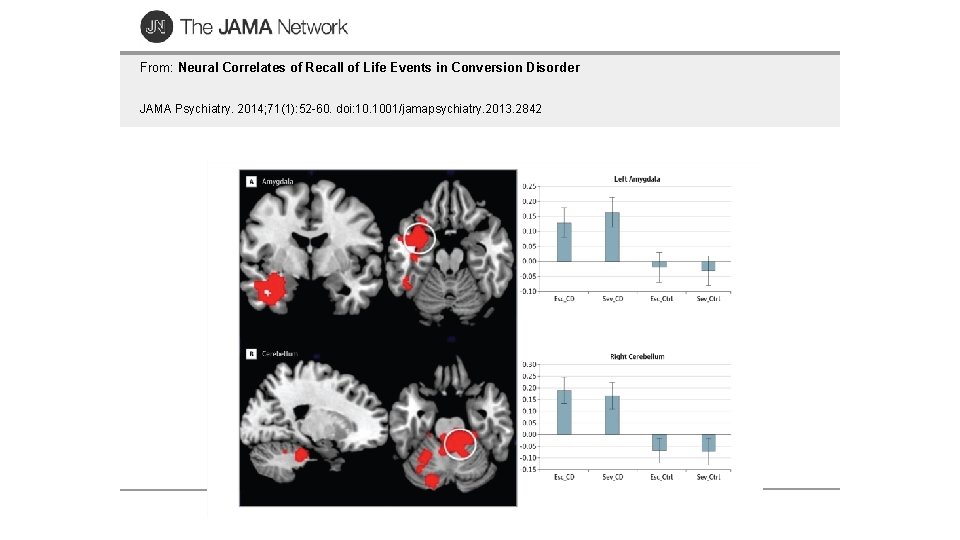 From: Neural Correlates of Recall of Life Events in Conversion Disorder JAMA Psychiatry. 2014;