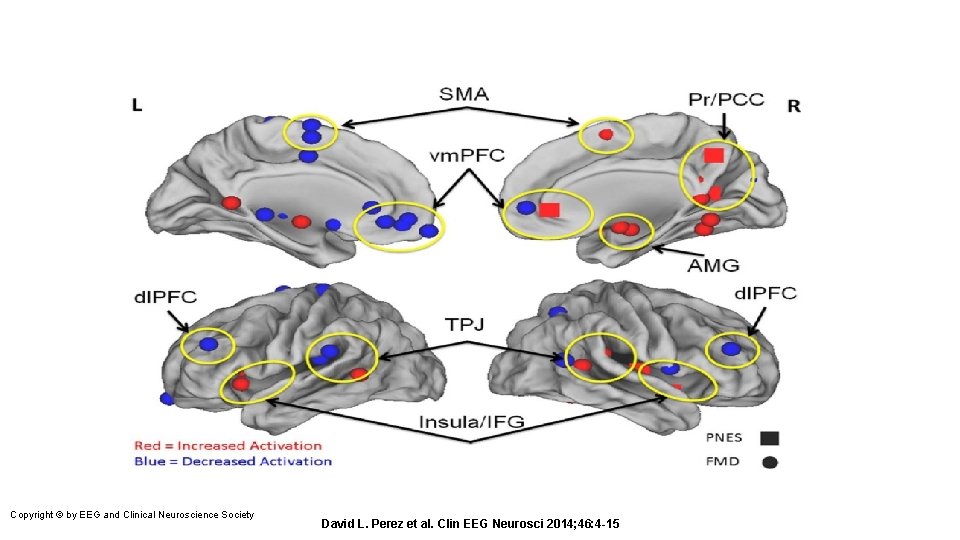 Copyright © by EEG and Clinical Neuroscience Society David L. Perez et al. Clin