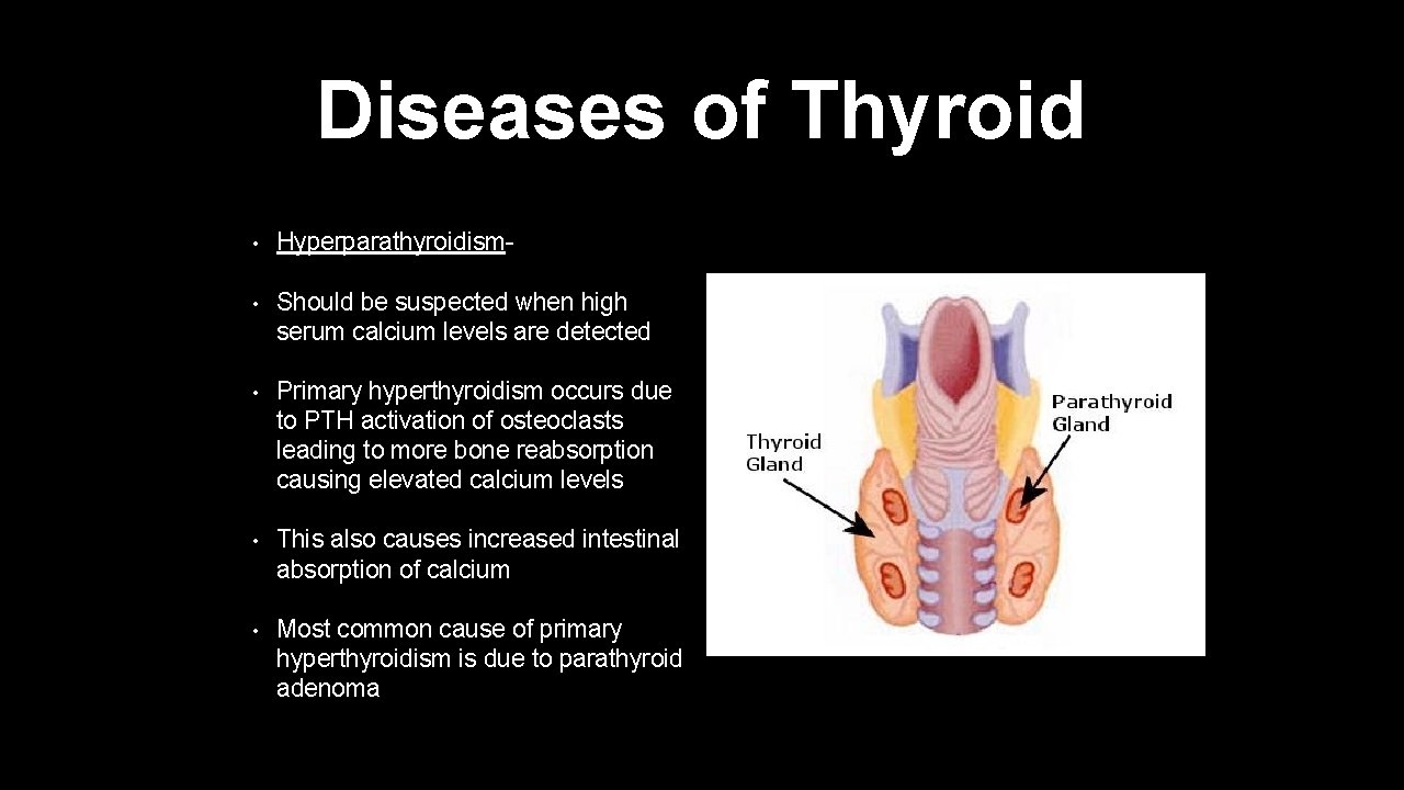 Diseases of Thyroid • Hyperparathyroidism- • Should be suspected when high serum calcium levels