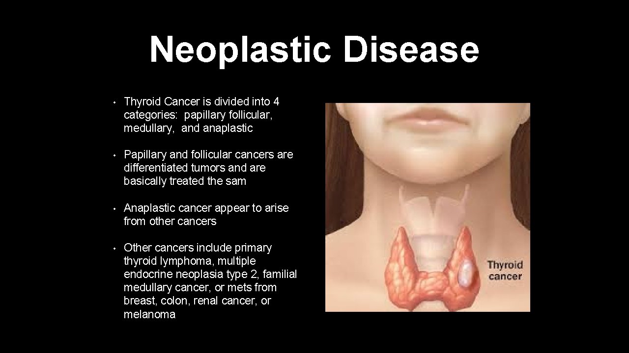 Neoplastic Disease • Thyroid Cancer is divided into 4 categories: papillary follicular, medullary, and