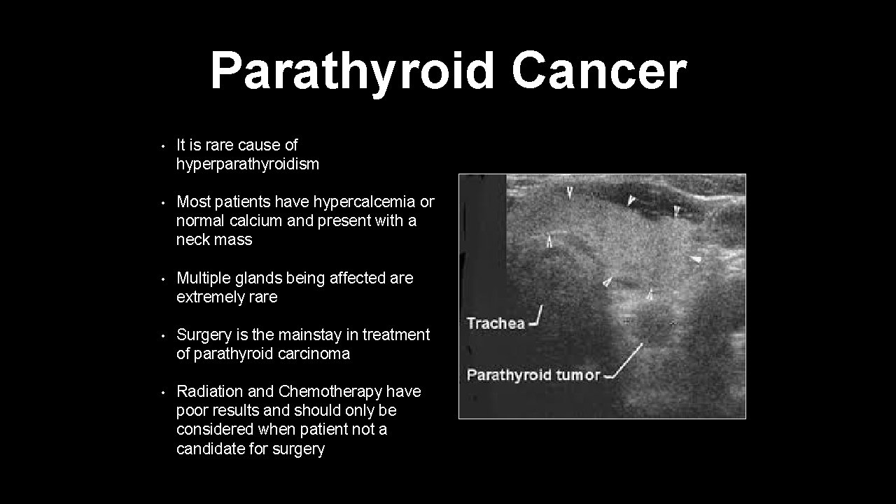 Parathyroid Cancer • It is rare cause of hyperparathyroidism • Most patients have hypercalcemia