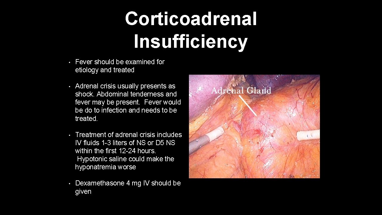 Corticoadrenal Insufficiency • Fever should be examined for etiology and treated • Adrenal crisis