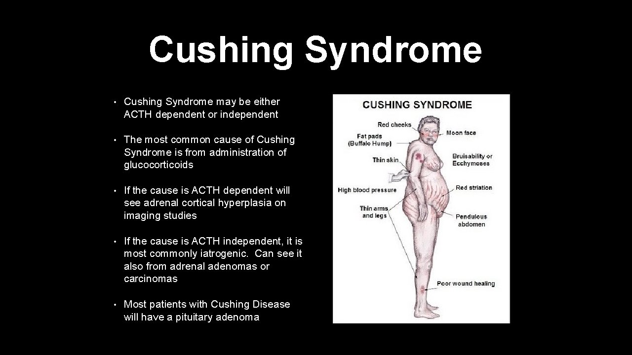 Cushing Syndrome • Cushing Syndrome may be either ACTH dependent or independent • The