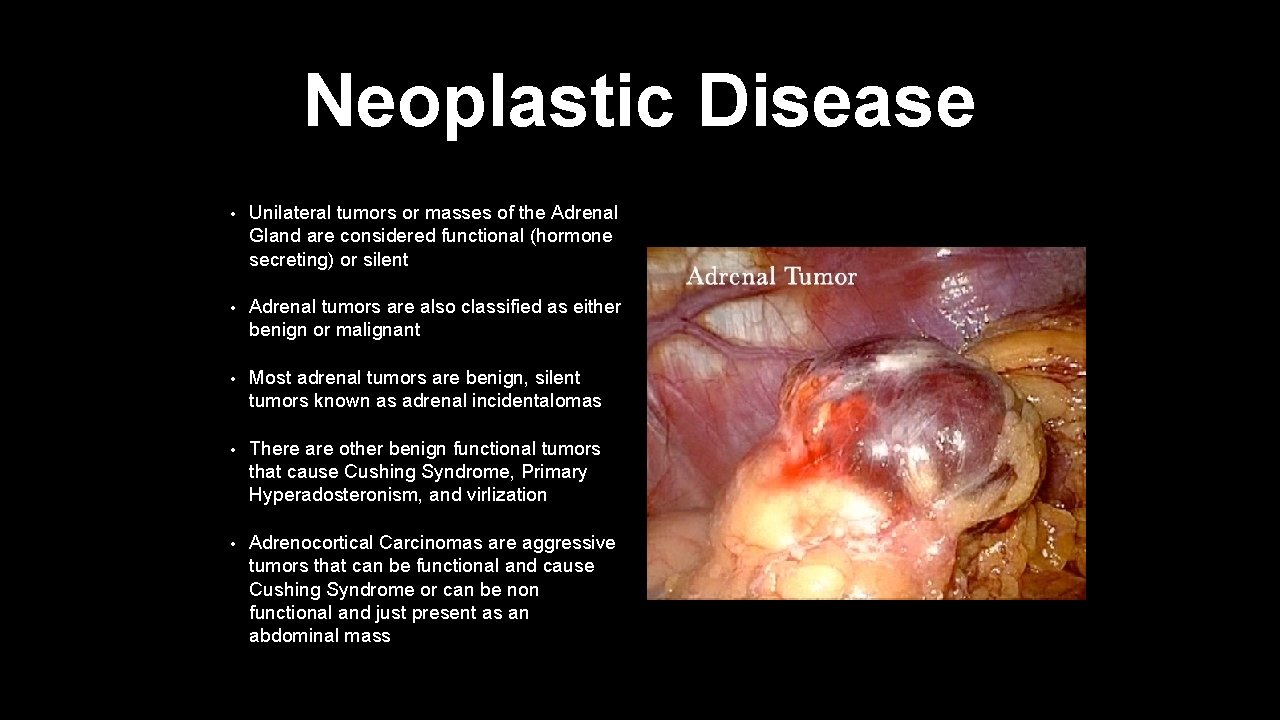 Neoplastic Disease • Unilateral tumors or masses of the Adrenal Gland are considered functional