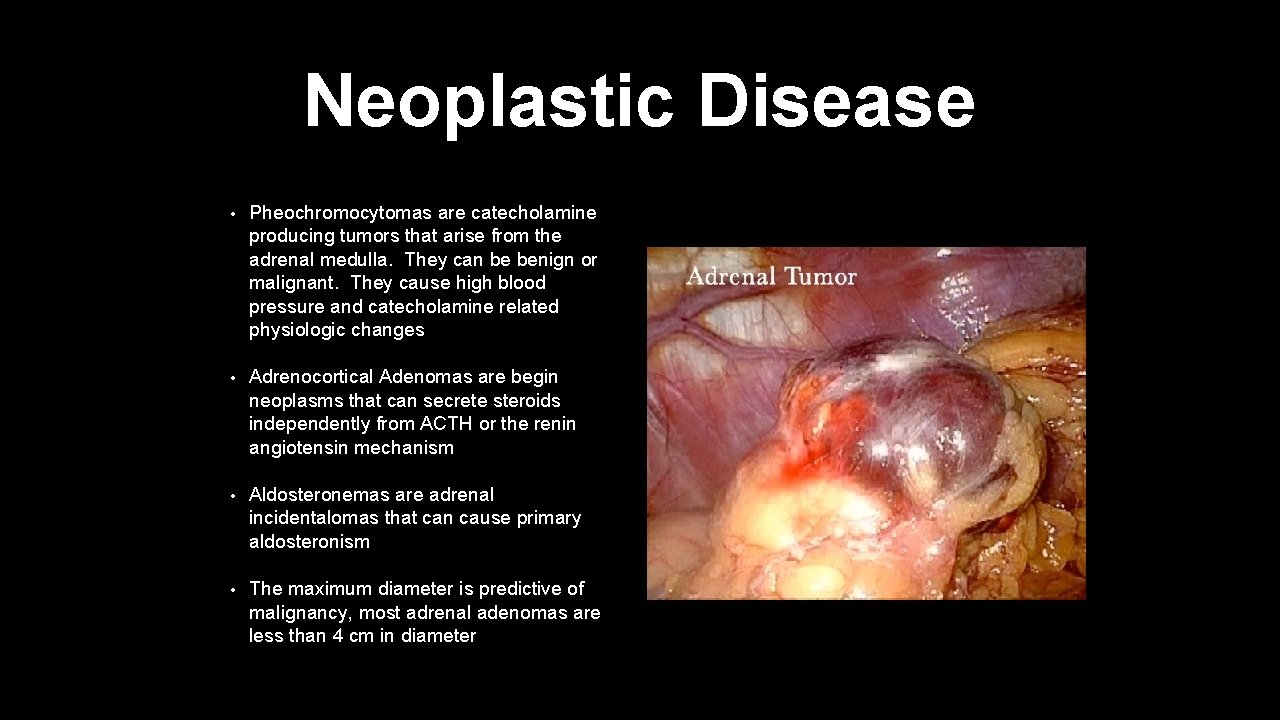 Neoplastic Disease • Pheochromocytomas are catecholamine producing tumors that arise from the adrenal medulla.