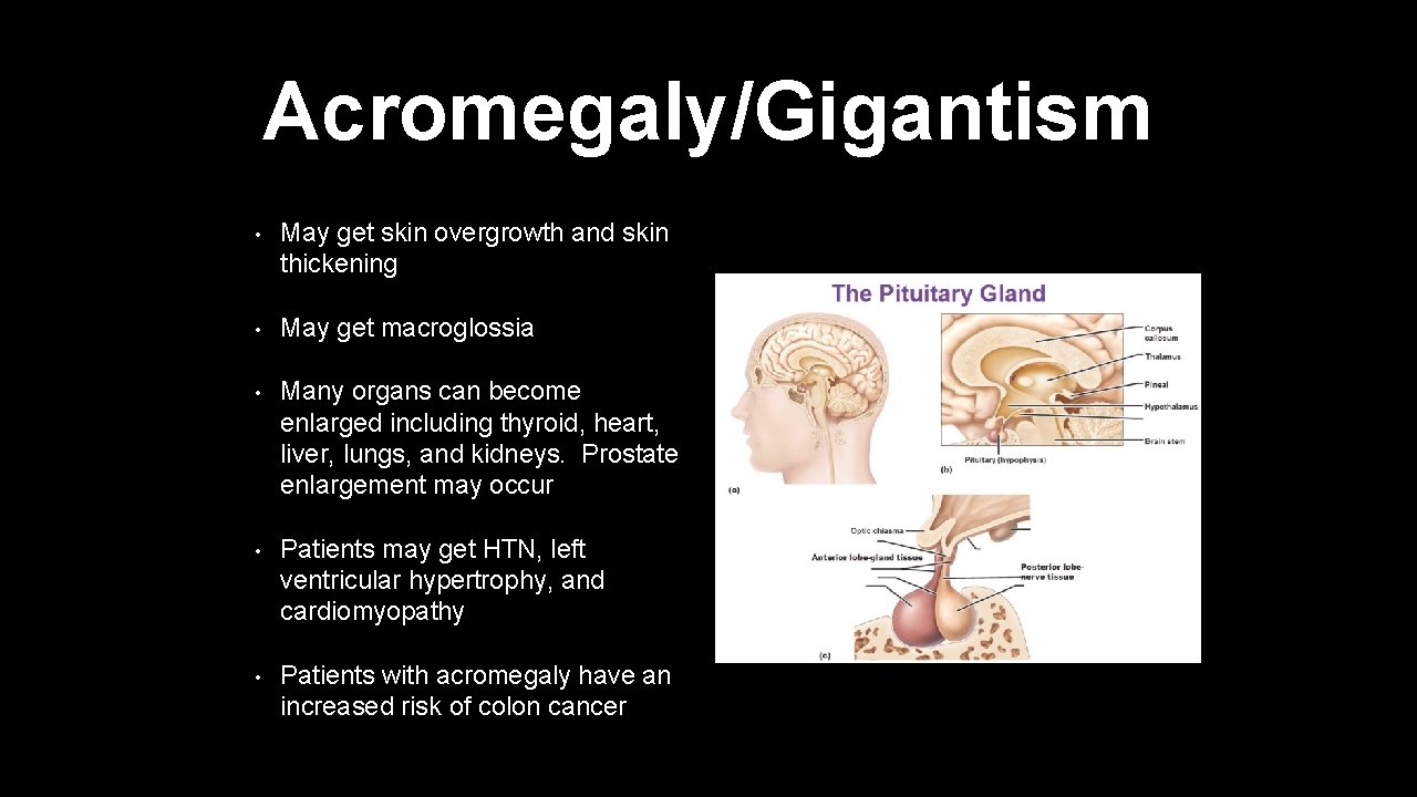 Acromegaly/Gigantism • May get skin overgrowth and skin thickening • May get macroglossia •