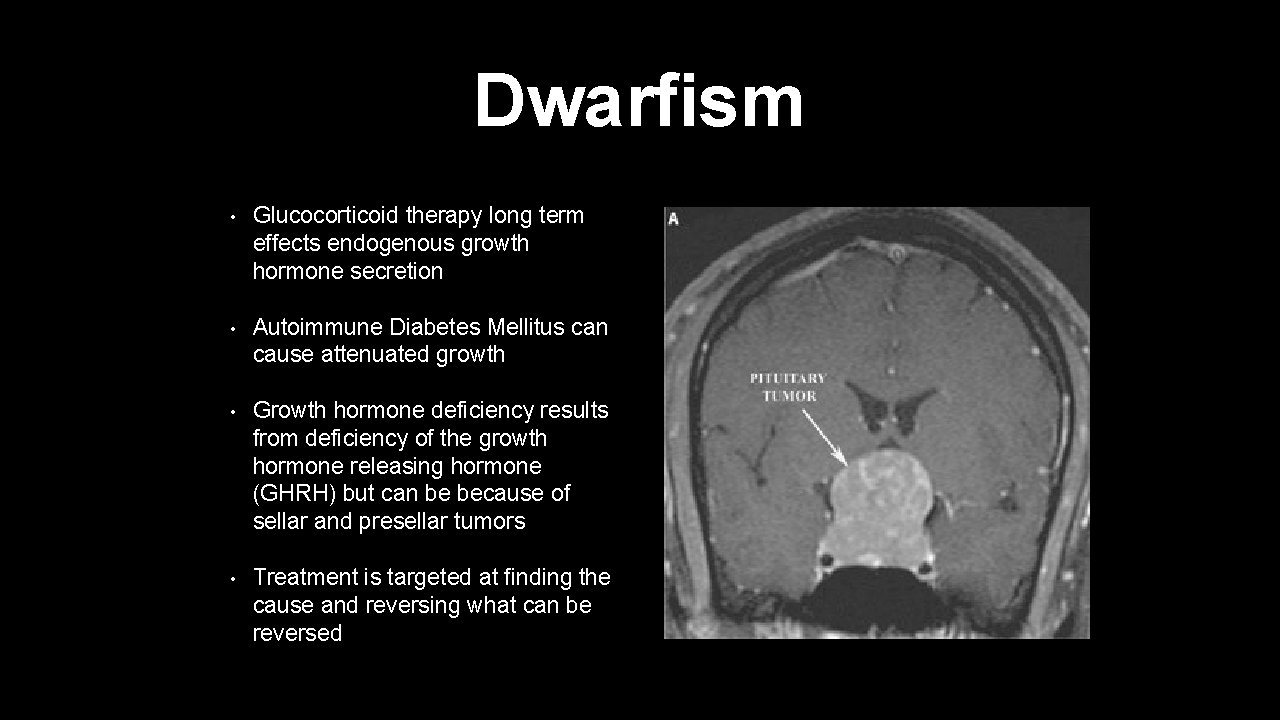 Dwarfism • Glucocorticoid therapy long term effects endogenous growth hormone secretion • Autoimmune Diabetes