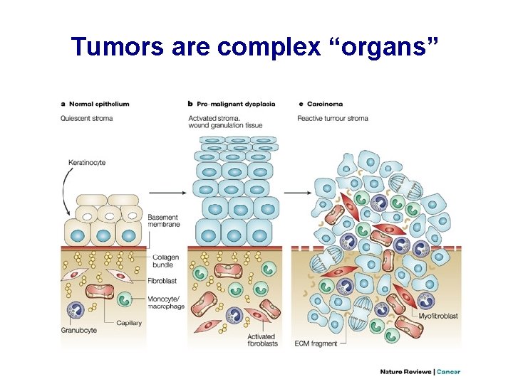 Tumors are complex “organs” 