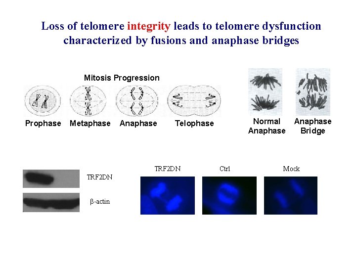 Loss of telomere integrity leads to telomere dysfunction characterized by fusions and anaphase bridges