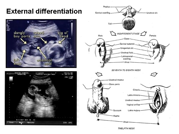 External differentiation 