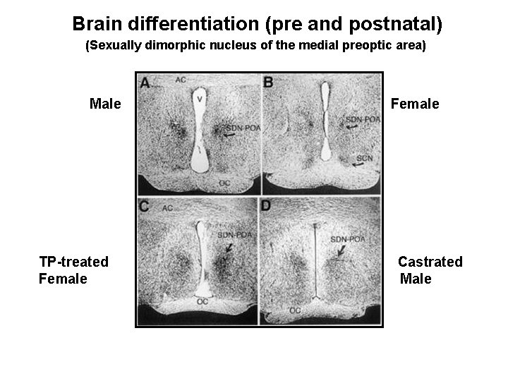 Brain differentiation (pre and postnatal) (Sexually dimorphic nucleus of the medial preoptic area) Male