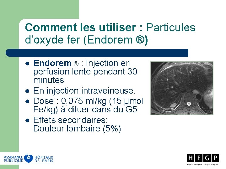 Comment les utiliser : Particules d’oxyde fer (Endorem ®) l l Endorem ® :