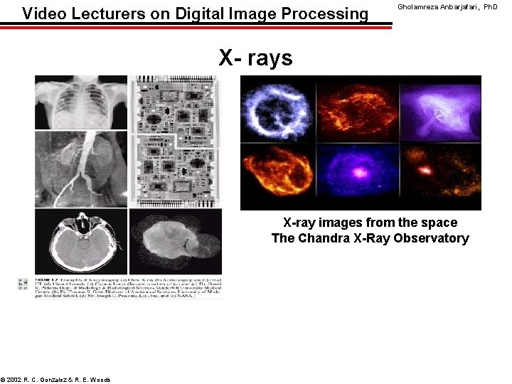 Video Lecturers on Digital Image Processing Gholamreza Anbarjafari, Ph. D X- rays X-ray images