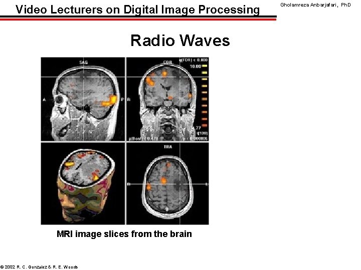 Video Lecturers on Digital Image Processing Radio Waves MRI image slices from the brain