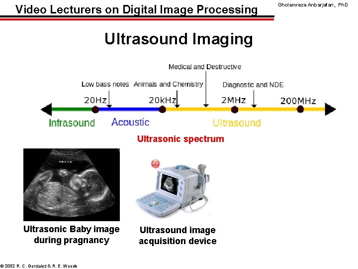 Video Lecturers on Digital Image Processing Ultrasound Imaging Ultrasonic spectrum Ultrasonic Baby image during