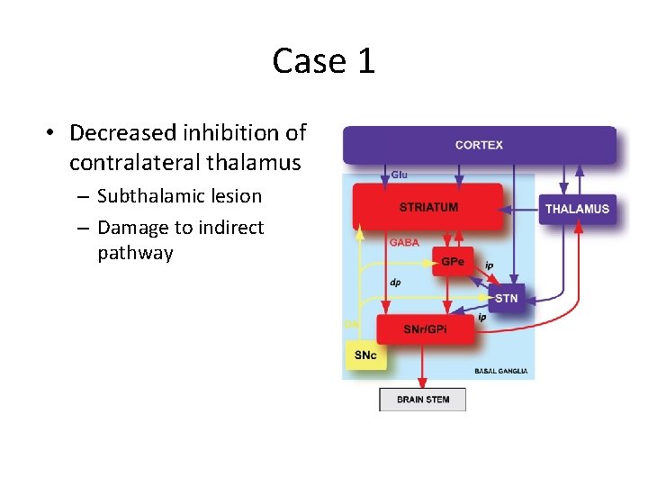 Case 1 • Decreased inhibition of contralateral thalamus – Subthalamic lesion – Damage to