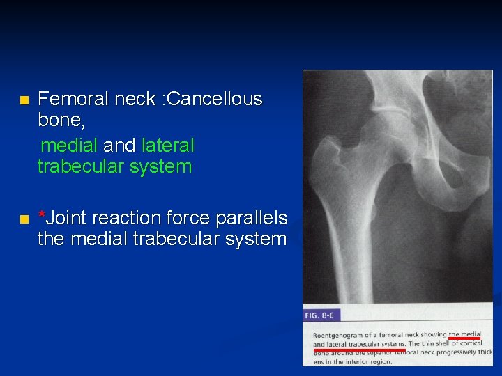 n Femoral neck : Cancellous bone, medial and lateral trabecular system n *Joint reaction