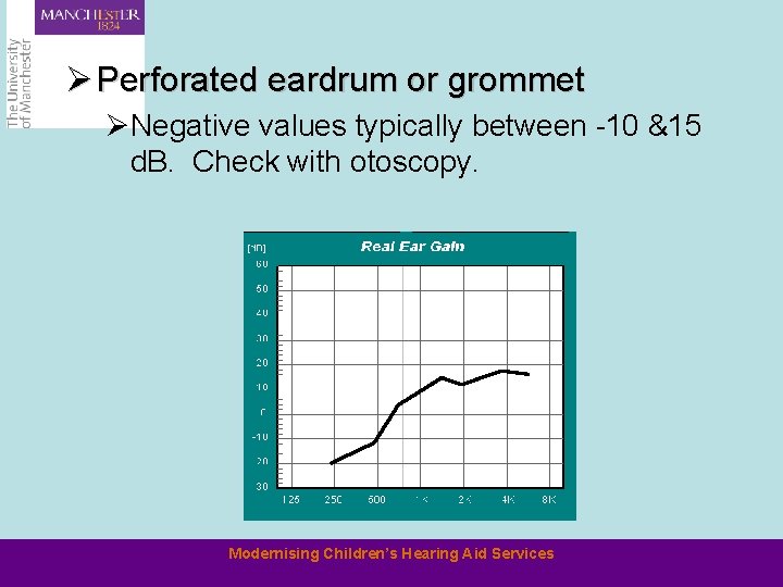 Ø Perforated eardrum or grommet ØNegative values typically between -10 &15 d. B. Check