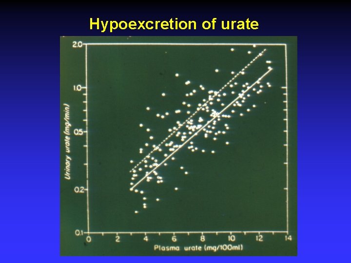 Hypoexcretion of urate 
