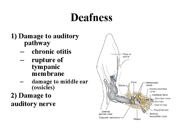 Deafness 1) Damage to auditory pathway – chronic otitis – rupture of tympanic membrane