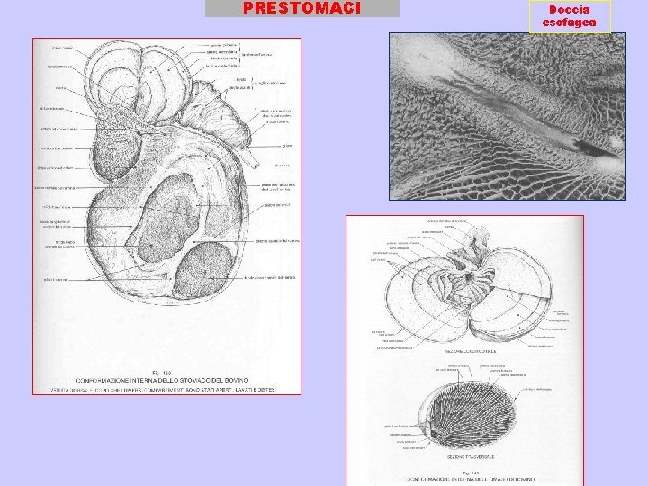 PRESTOMACI Doccia esofagea 