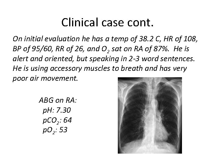 Clinical case cont. On initial evaluation he has a temp of 38. 2 C,