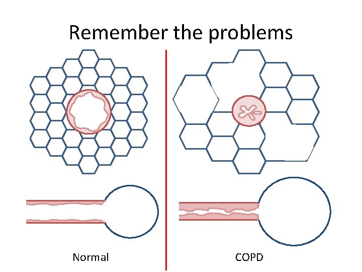 Remember the problems Normal COPD 