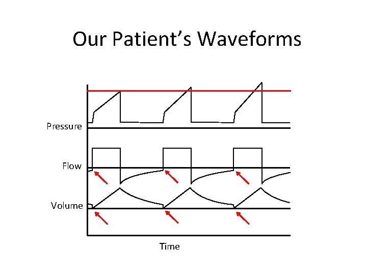 Our Patient’s Waveforms Pressure Flow Volume Time 