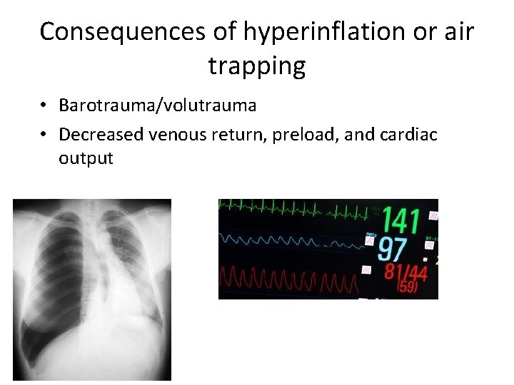 Consequences of hyperinflation or air trapping • Barotrauma/volutrauma • Decreased venous return, preload, and