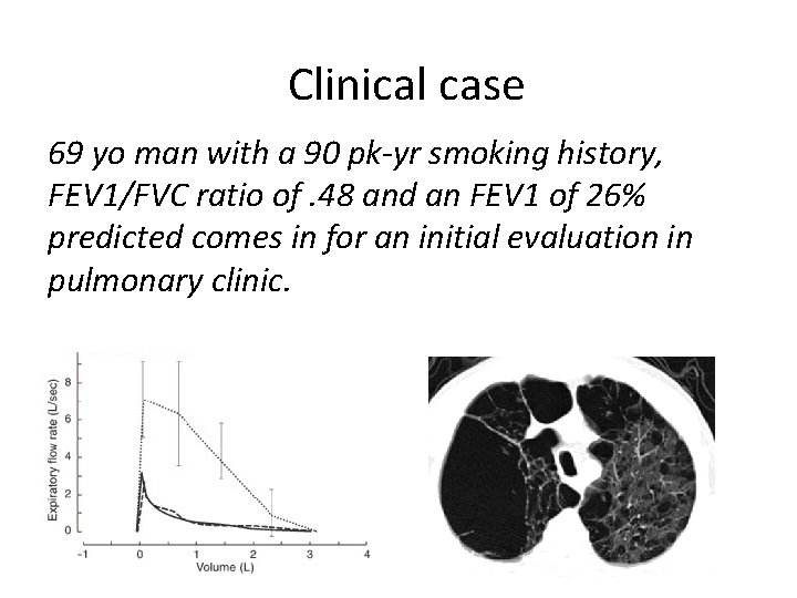 Clinical case 69 yo man with a 90 pk-yr smoking history, FEV 1/FVC ratio