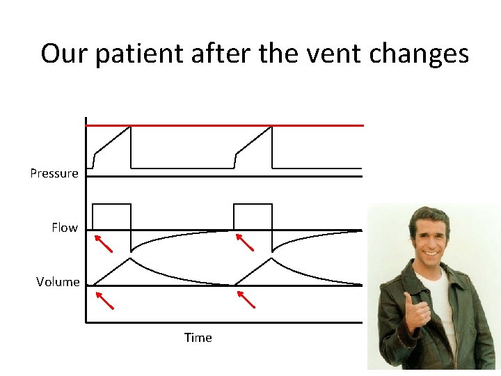 Our patient after the vent changes Pressure Flow Volume Time 