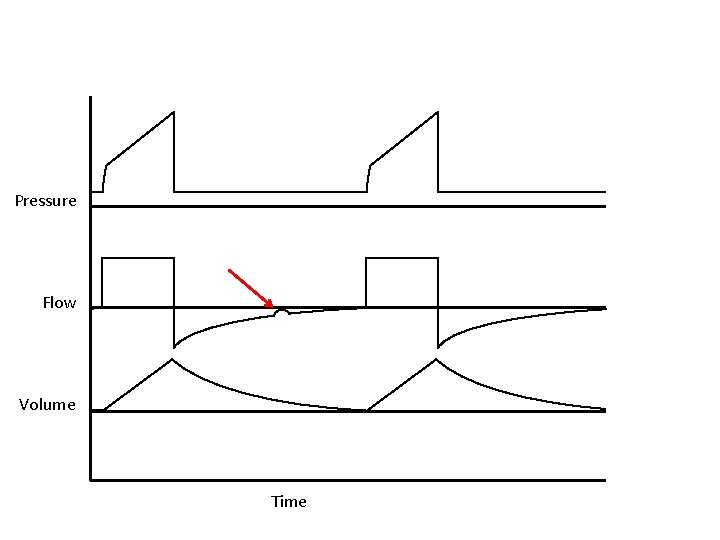 Pressure Flow Volume Time 