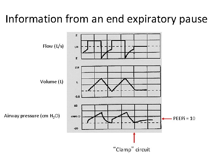 Information from an end expiratory pause Flow (L/s) Volume (L) Airway pressure (cm H