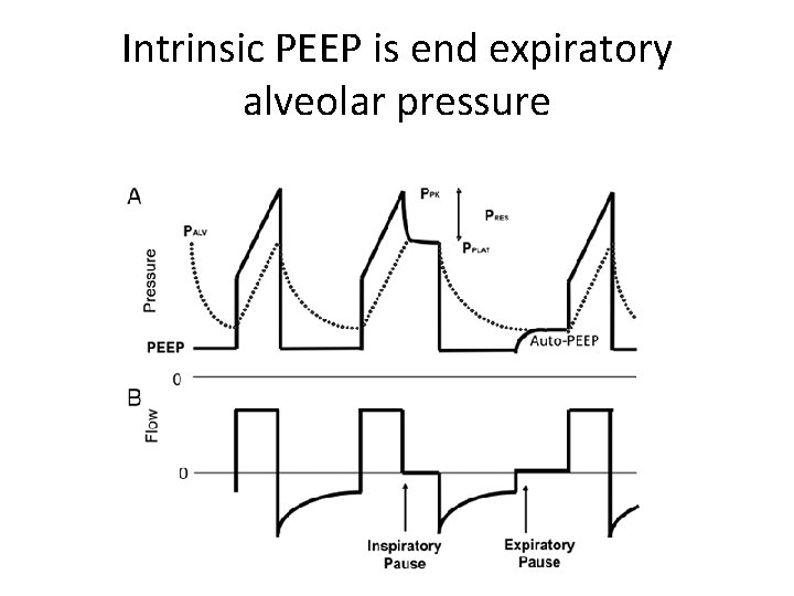 Intrinsic PEEP is end expiratory alveolar pressure 