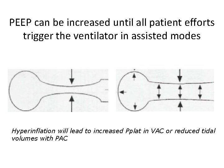 PEEP can be increased until all patient efforts trigger the ventilator in assisted modes