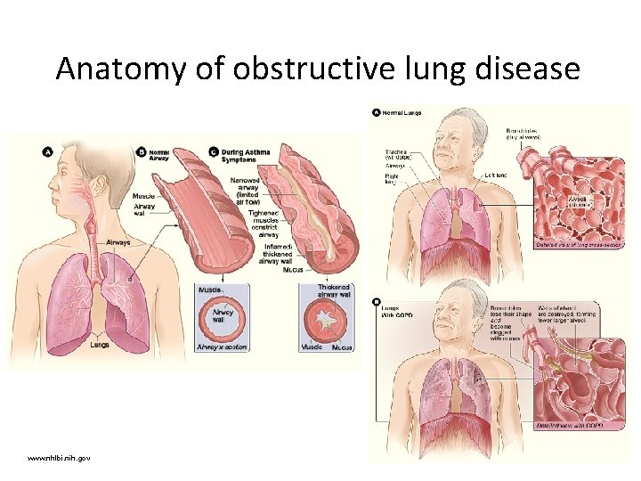 Anatomy of obstructive lung disease www. nhlbi. nih. gov 