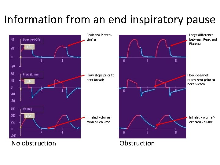 Information from an end inspiratory pause Peak and Plateau similar Large difference between Peak