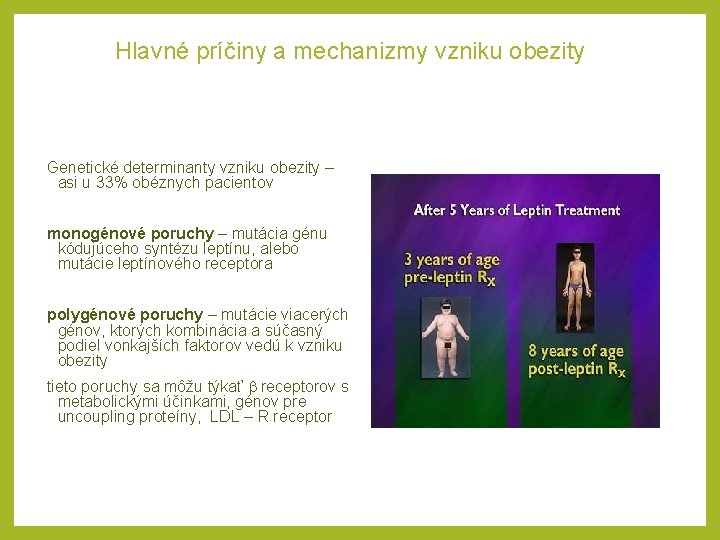 Hlavné príčiny a mechanizmy vzniku obezity Genetické determinanty vzniku obezity – asi u 33%