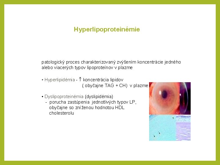 Hyperlipoproteinémie patologický proces charakterizovaný zvýšením koncentrácie jedného alebo viacerých typov lipoproteínov v plazme •