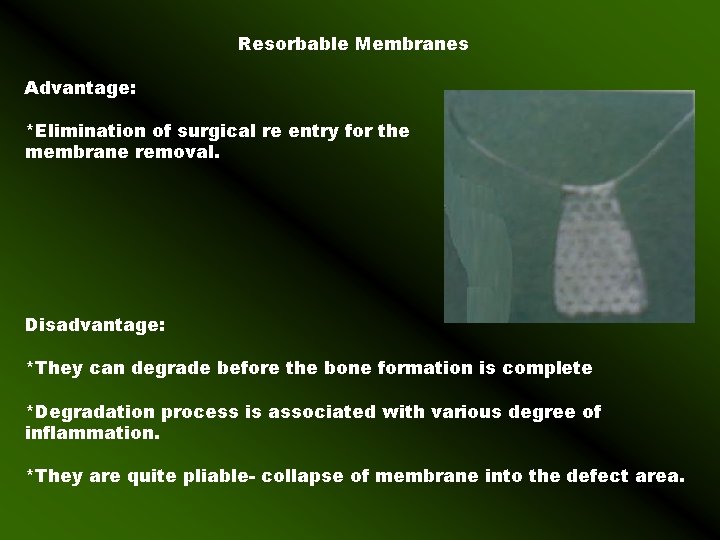 Resorbable Membranes Advantage: *Elimination of surgical re entry for the membrane removal. Disadvantage: *They