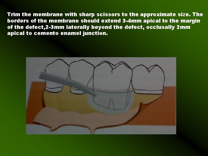 Trim the membrane with sharp scissors to the approximate size. The borders of the