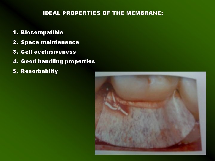 IDEAL PROPERTIES OF THE MEMBRANE: 1. Biocompatible 2. Space maintenance 3. Cell occlusiveness 4.