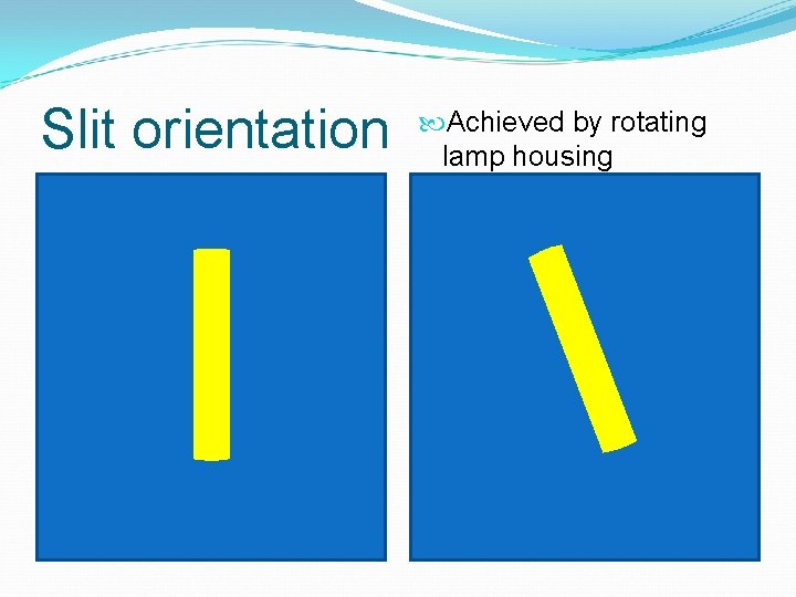 Slit orientation Achieved by rotating lamp housing 