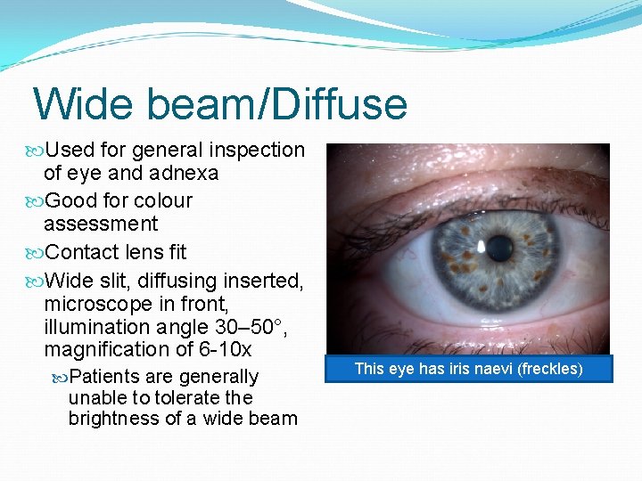 Wide beam/Diffuse Used for general inspection of eye and adnexa Good for colour assessment